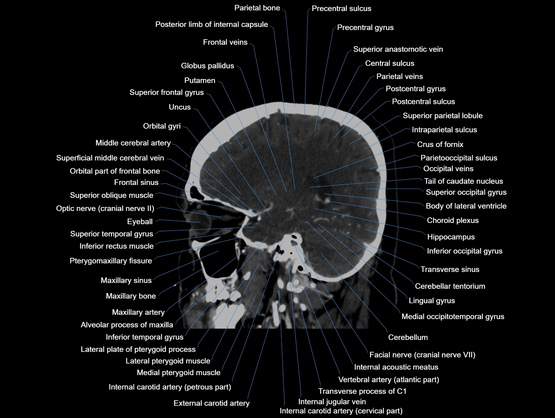 CT scan brain sagittal cross sectional anatomy image-img-00001-00027.webp